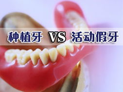 深圳口腔治疗 深圳五洲数字口腔治疗中心