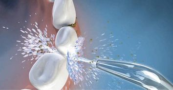 专心做产品,xwaves冲牙器有何优势