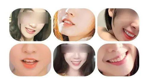 扩散 免费领看牙补贴,佛山市民0门槛在线领取,不限户籍