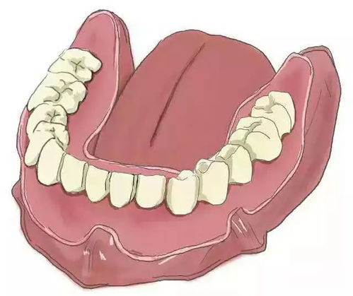 真的知道种植牙是怎么种的吗?详细解析种植牙流程与原理