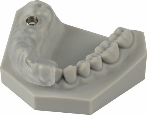 口腔诊疗数字化，让种植牙体验焕然一新