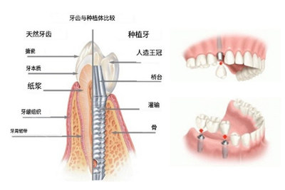 长春叁肆伍口腔医院 市民信赖的“义齿工厂”，种植牙口碑评价一览