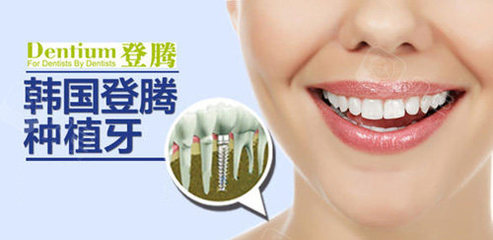 牙齿掉了选什么品牌好?各国品牌种植牙优势与价格汇总